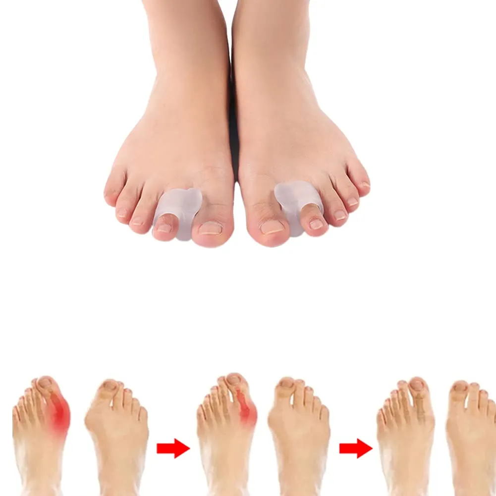 4pcs Soft and Gentle Clear Gel Toe Separators for Overlapping Toes Bunions Big Toe Alignment Corrector and Spacer - Large